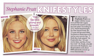 Illustration for article titled This Week In Tabloids: Lindsay May Have Robbed Herself; Demi's "Never" Had Plastic Surgery